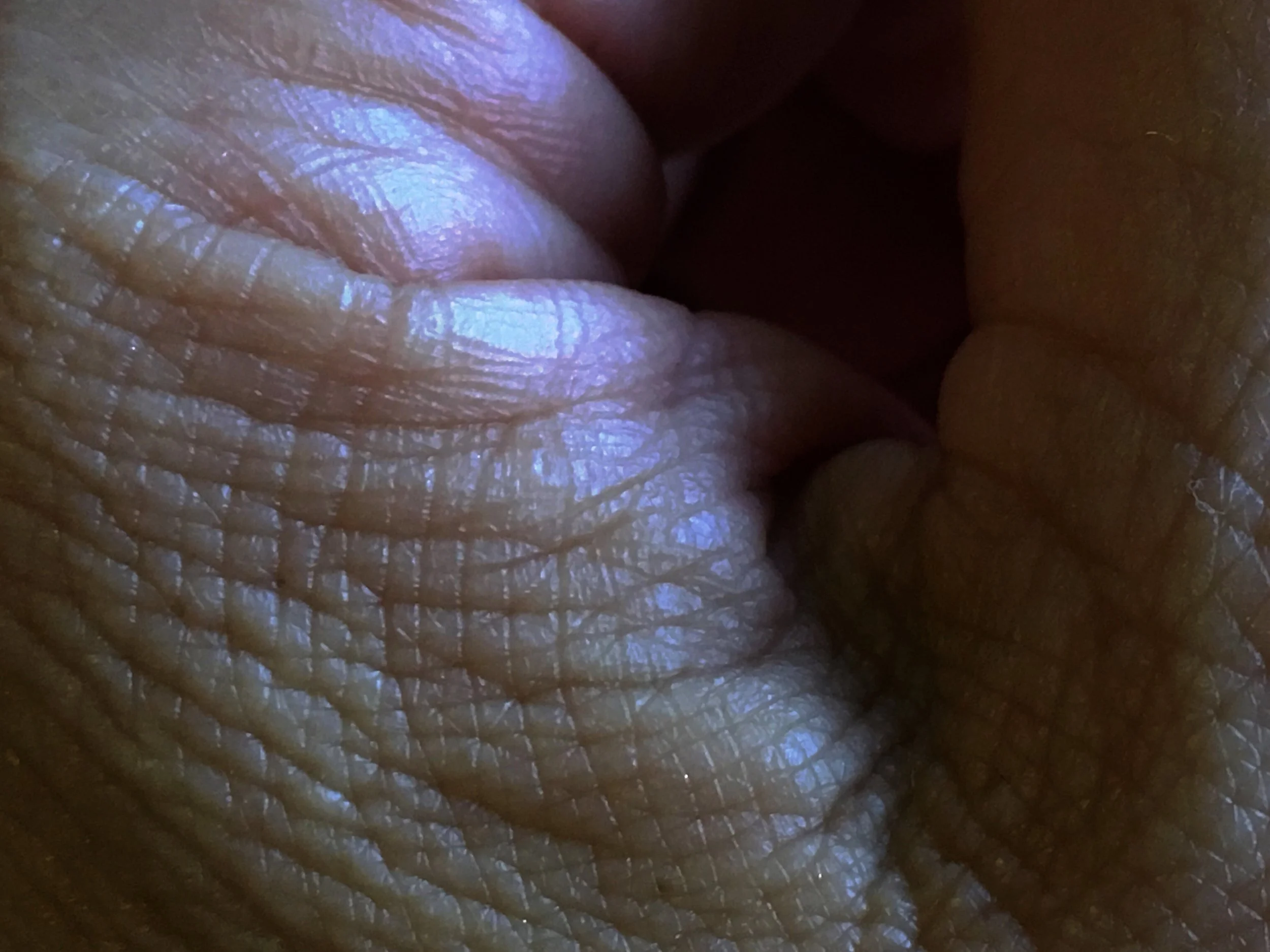 Flesh © Naida Ginnane 2018, iPhone 6, Camera+ App on macro.