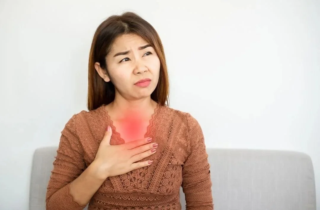 Acid Reflux
