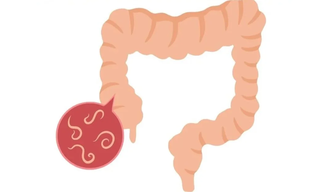 Pinworms &amp; Threadworms