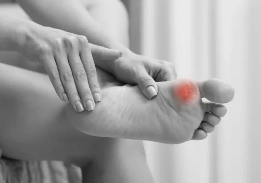 NEW 2026 - Calluses, Corns, Warts