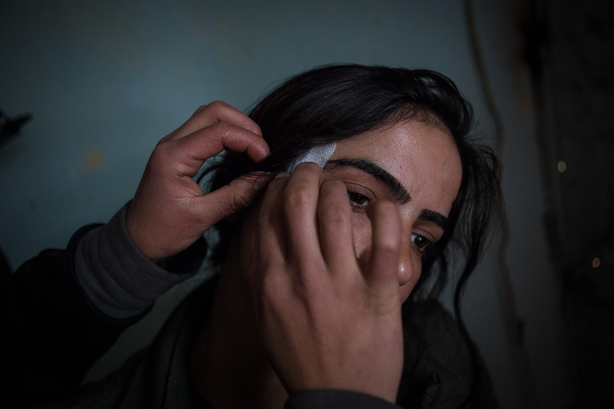  A PKK guerrilla is bandaged after being wounded by shrapnel while fighting ISIS militants in Sinjar, Iraq.  