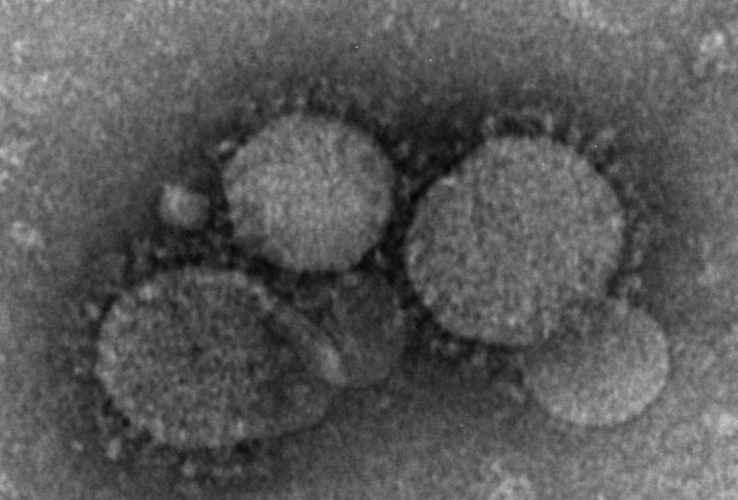 The 5 deadliest viruses on Earth Created In Labs