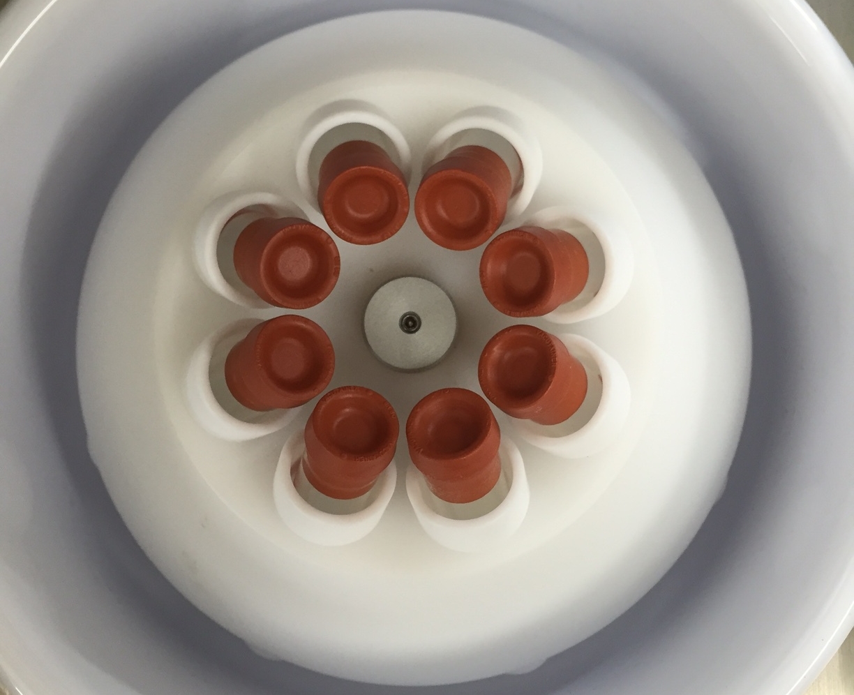 We spin the blood down in a centrifuge to separate the platelet-rich plasma from the red blood cells.