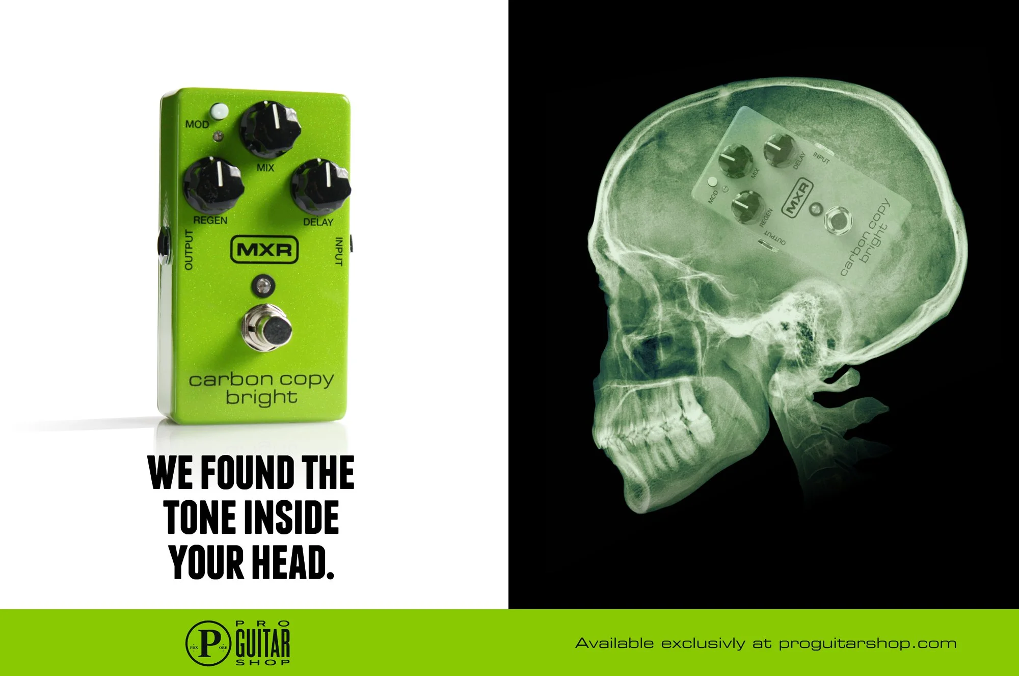 Skull_X-Ray_11x17.jpg