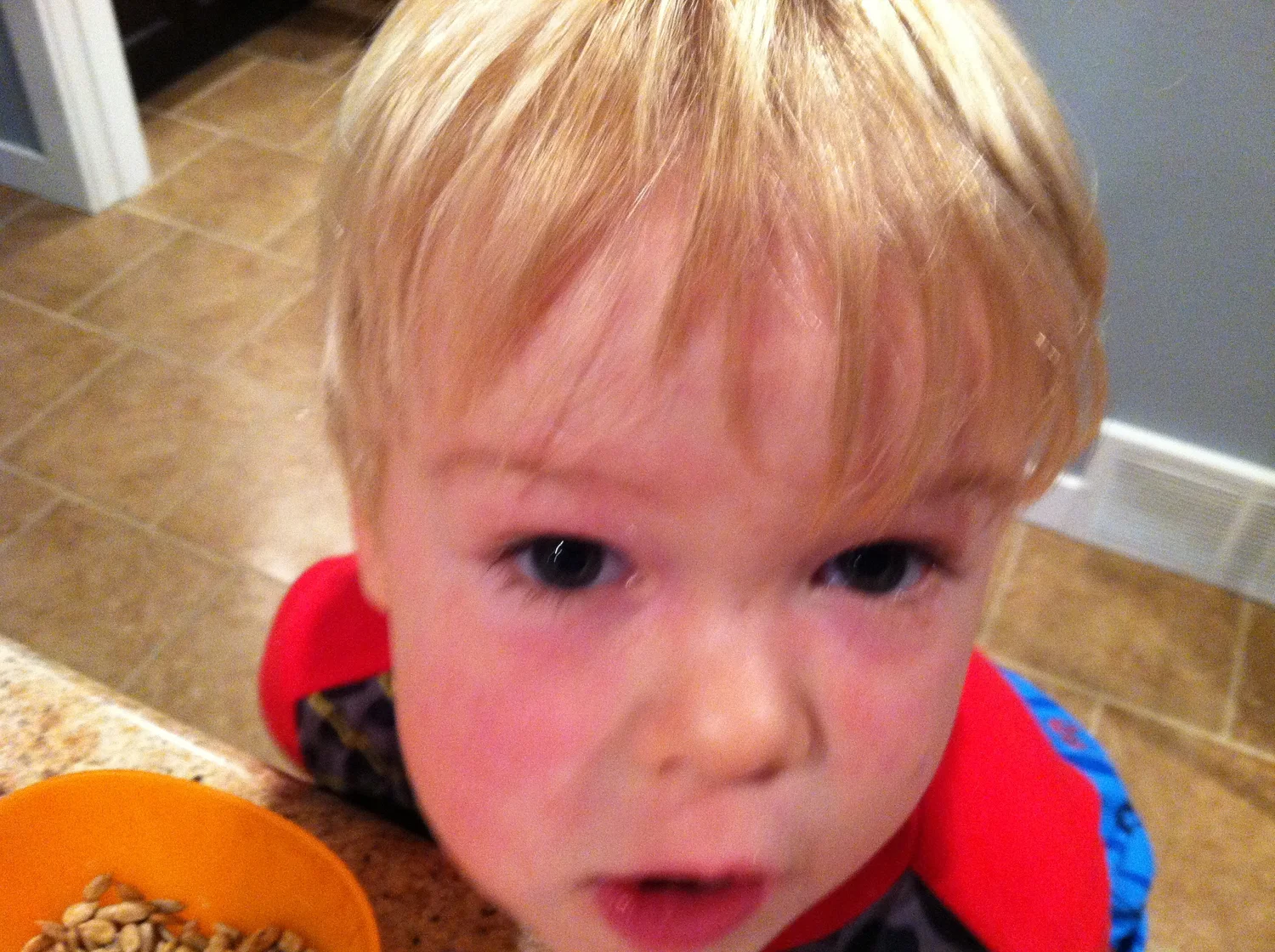 Dealing with a Severe Adhesive Allergy — JUICEBOX PODCAST