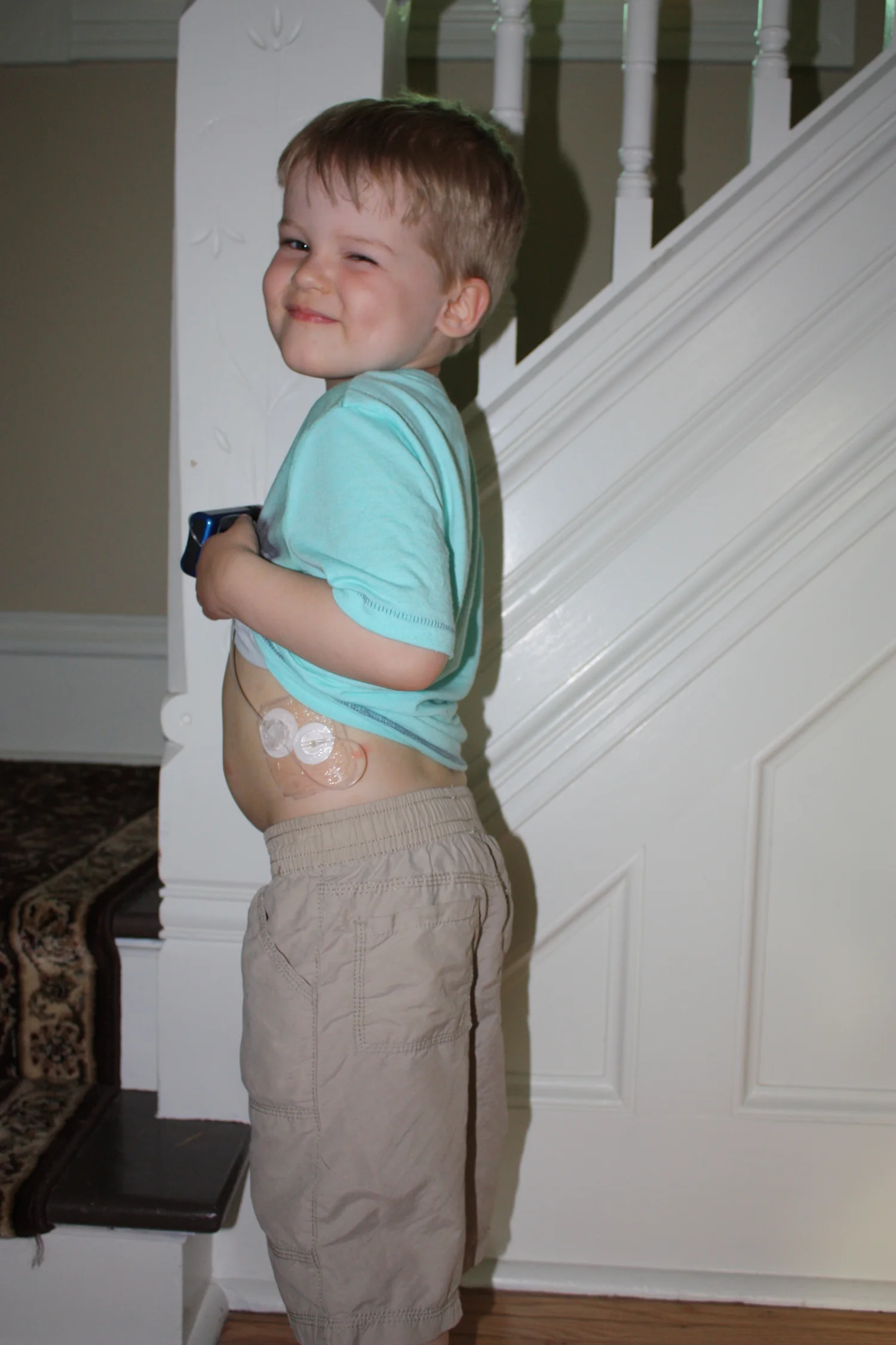 Dealing with a Severe Adhesive Allergy — JUICEBOX PODCAST