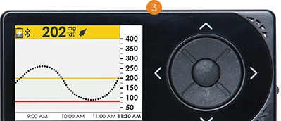 Image from Dexcom.com
