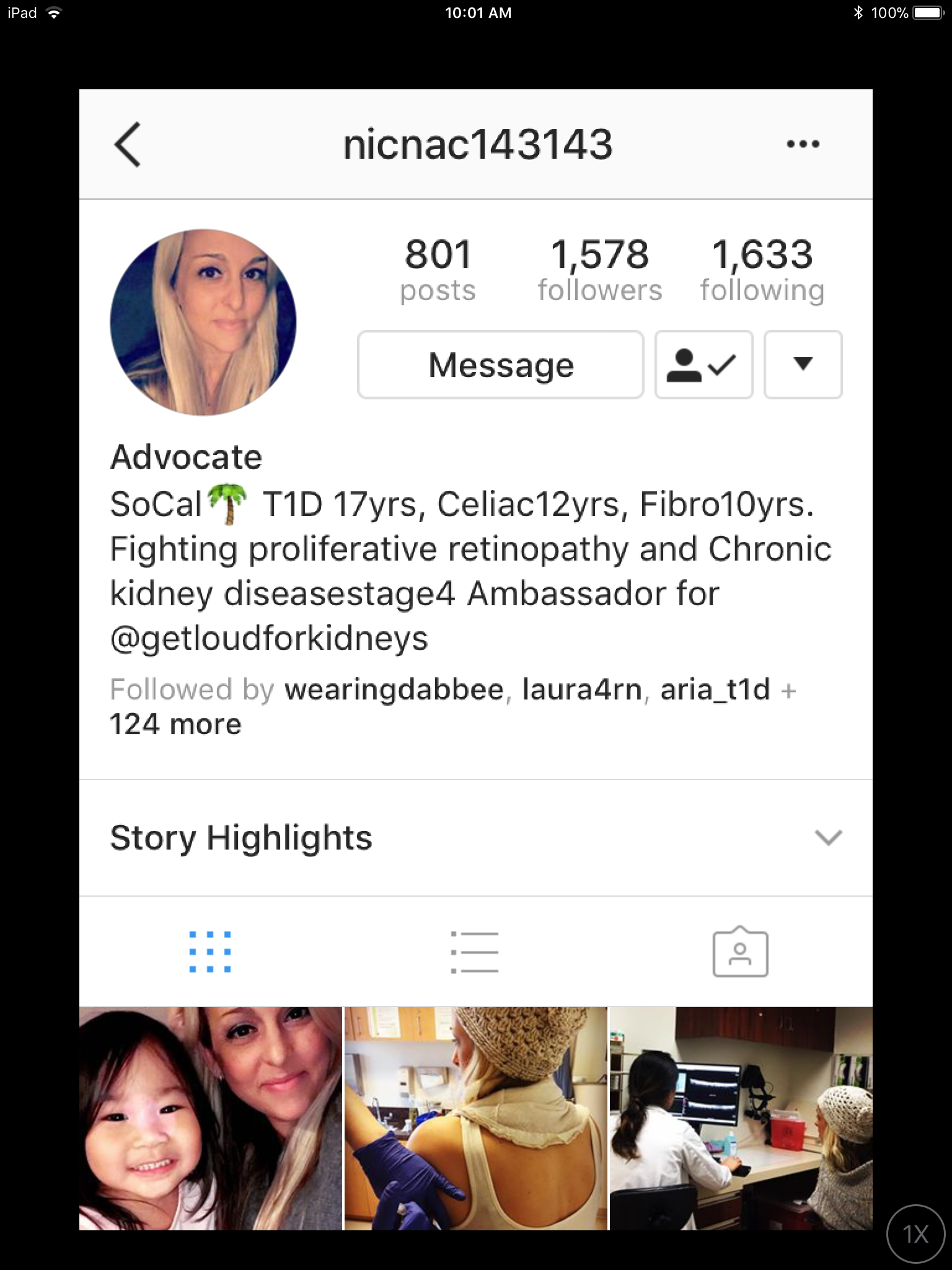 #151 Complications are Complicated 