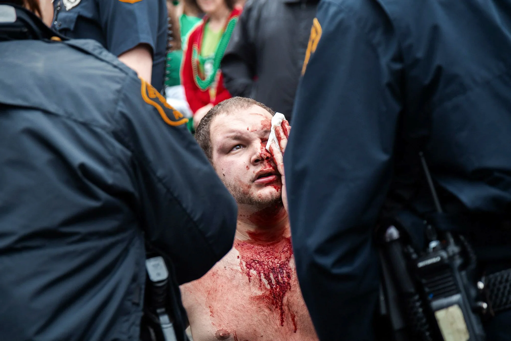 A man surrounded by police officers holds a cloth to a wound on his face received during an altercation with a fellow St. Patrick's Day reveler in Market Square in downtown Pittsburgh, PA on March 14th, 2015. Cities across the U.S. host annual St. Patrick's Day parades and celebrations, but critics say they reinforce excessive drinking that puts an undue burden on public health and safety.