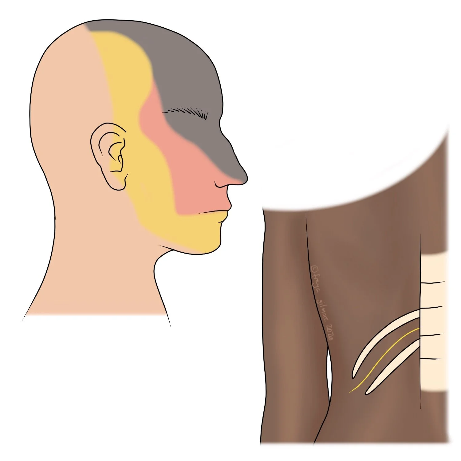 Neuralgia