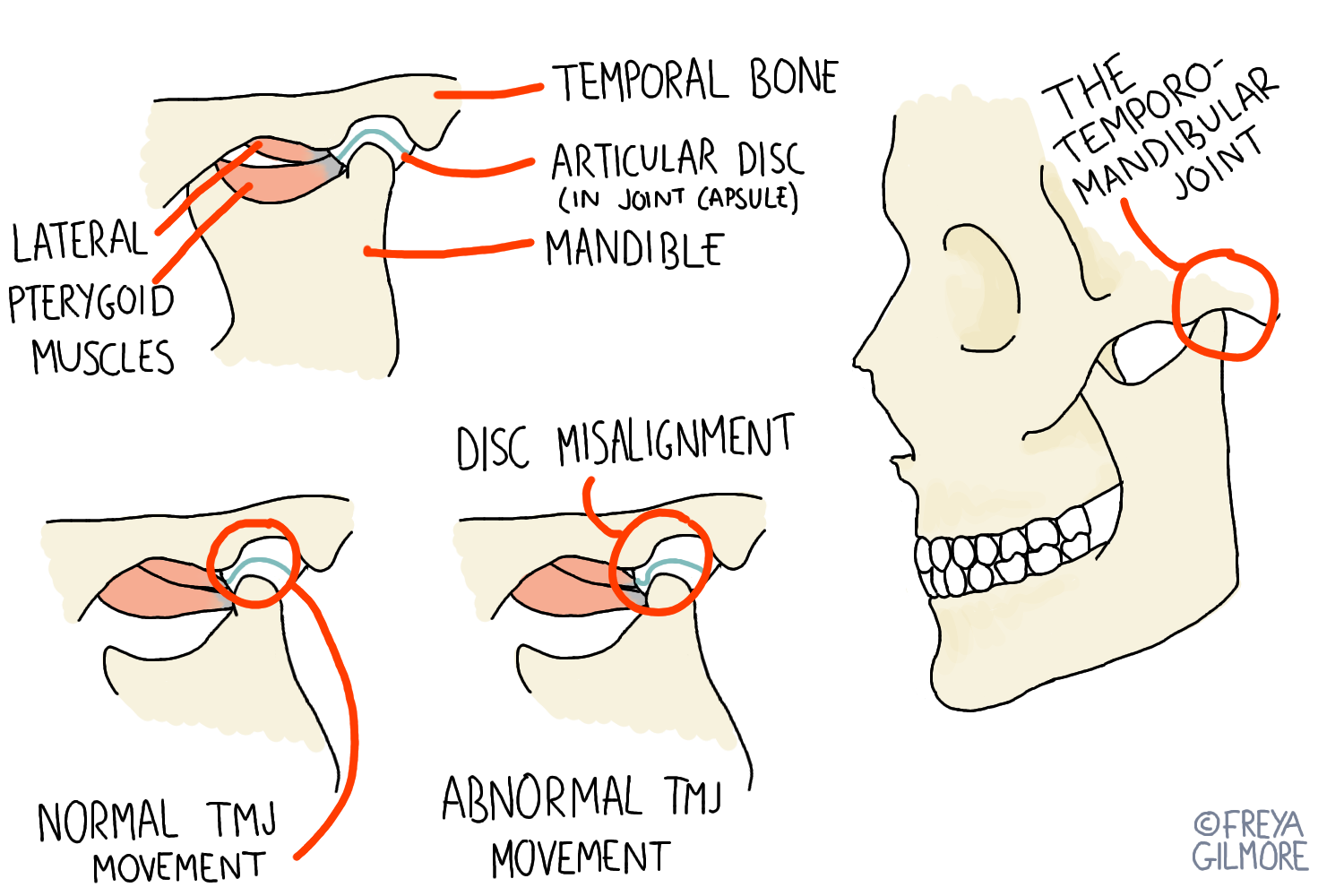 TMJ: Jaw Pain and Clicking