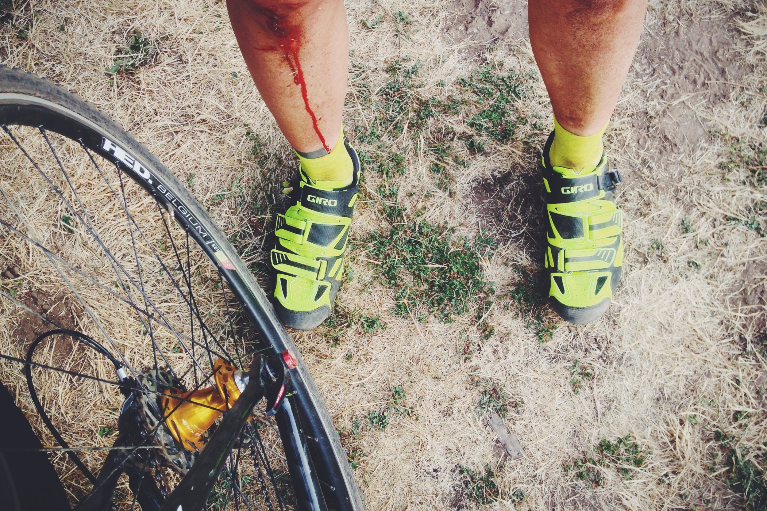 If you race enough cross, sooner or later you're going to go down. There's a little more blood in summer cross because there's no slippery layer of mud to cushion your fall.