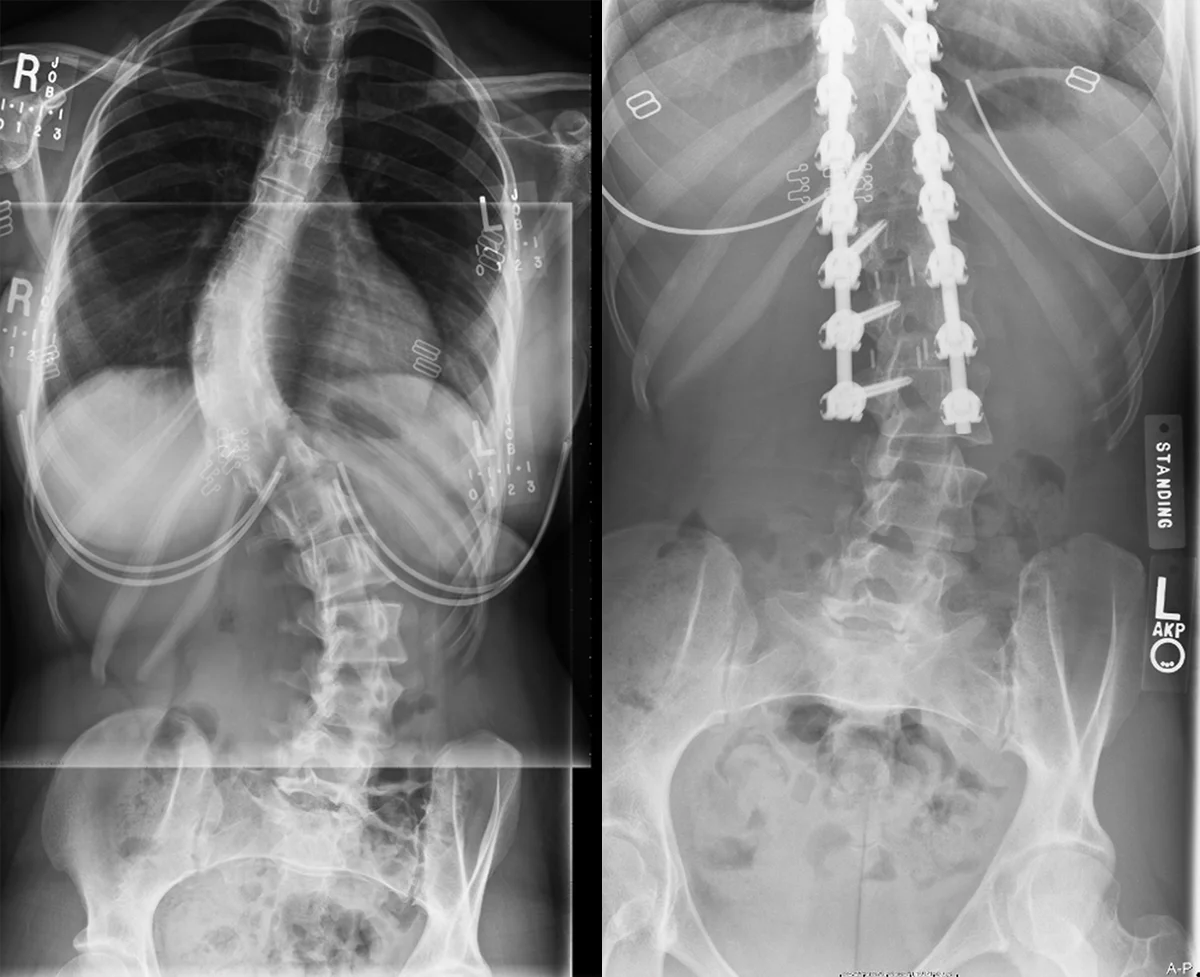 60 Degree curve before, 15 degree curve after