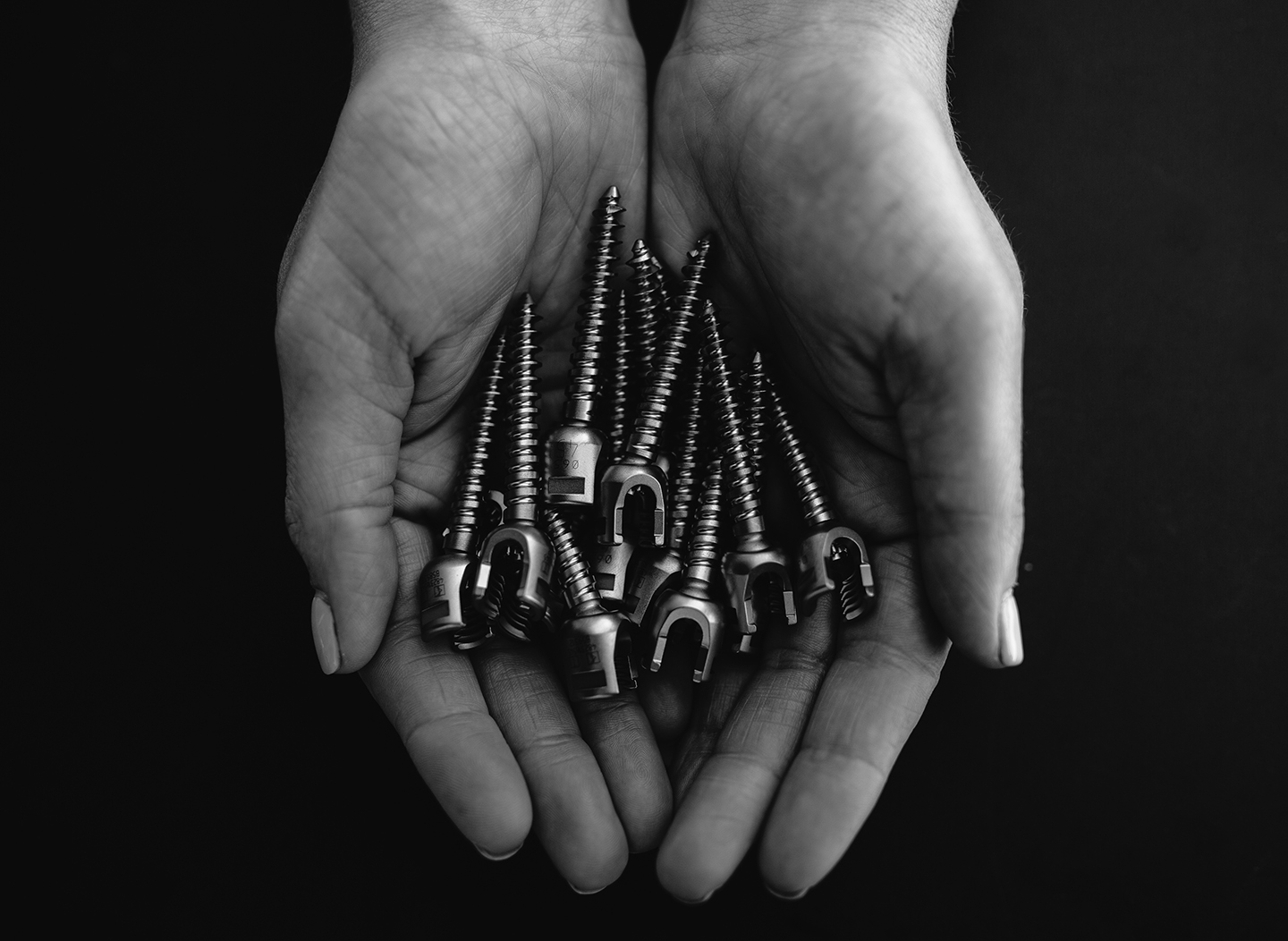 20 Screws shown above are the same screws I have in my back. 