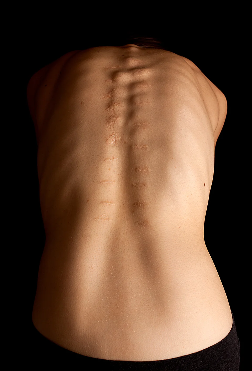 These photos of my back and portraits were a collaboration with my dear friend, Tori Dickson. I met Tori at church the week before my back surgery. Tori was assigned from our church women's group to visit me in the hospital. I was eating lunch when she arrived. Side story: My right side went numb during surgery from nerve damage. I couldn't hold a fork myself or sit up. My mom had to step out of my room for a while. She asked Tori if she wouldn't mind feeding me. So how did Tori and I become friends? She spoon fed me yogurt in the hospital. It was one of the weirder starts to a friendship. But a friendship that's grown as strong as my titanium back. I've been so nervous to share these, because I'm ultra conservative, modest. 