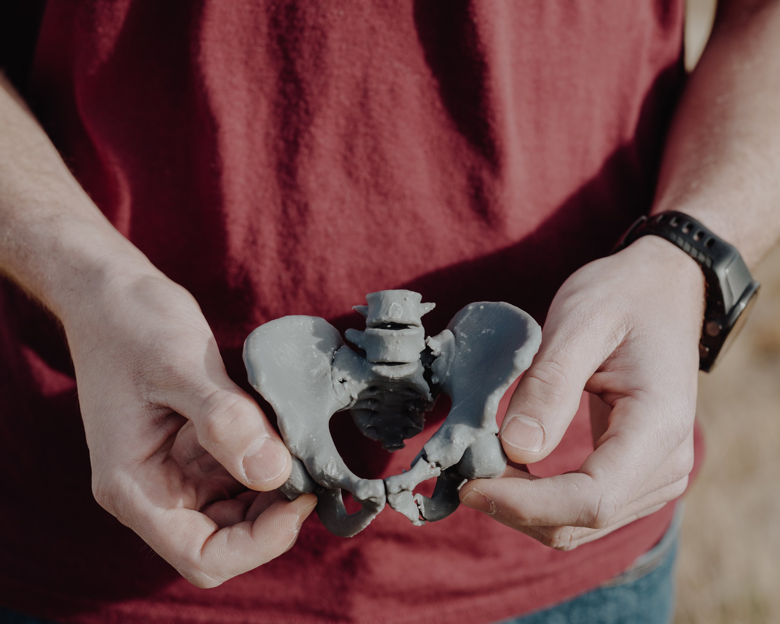  Smokejumper Jackson Spooner holding a 3D printed model of his pelvis fracture - photographed for  BuzzFeed News  