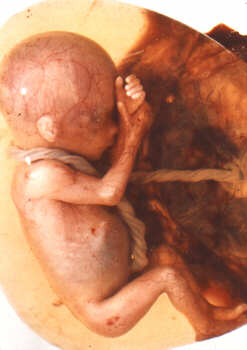 / image from pregnant pause