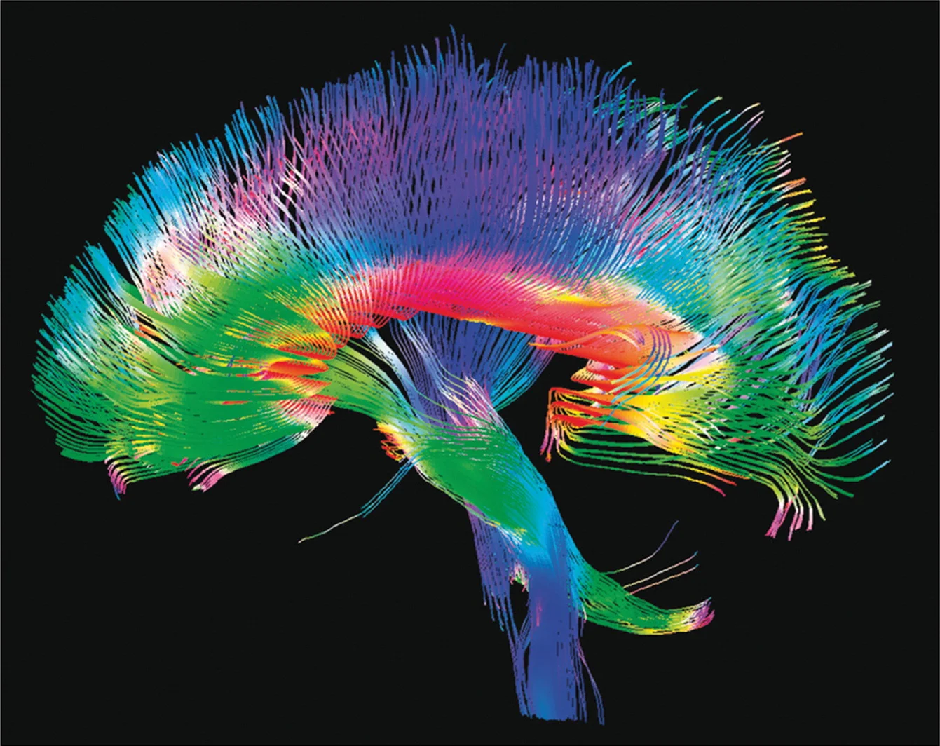 Human Connectome 
