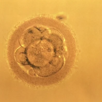Our little embryo before transfer