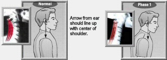 Normal head posture