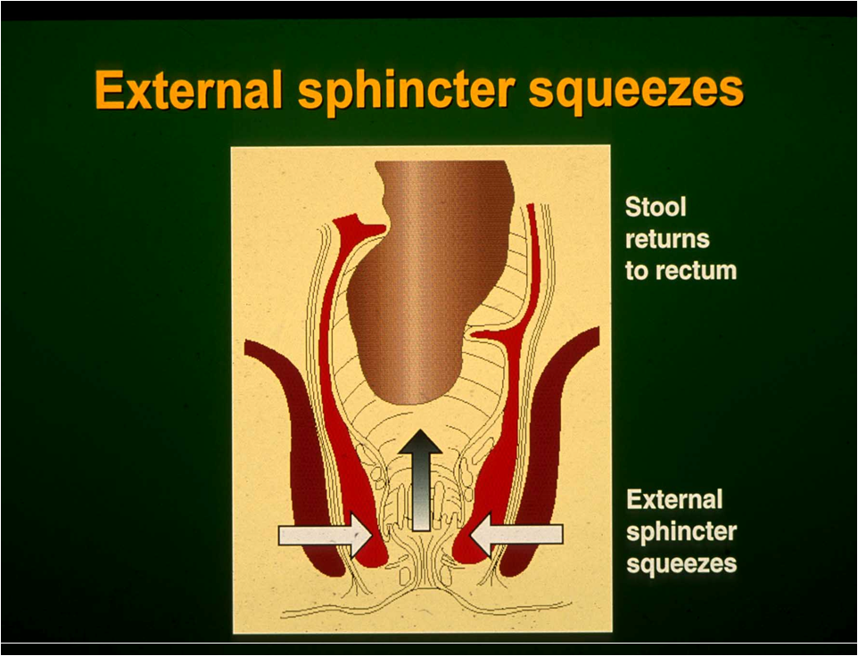 external sphincter squeeze C Norton.png
