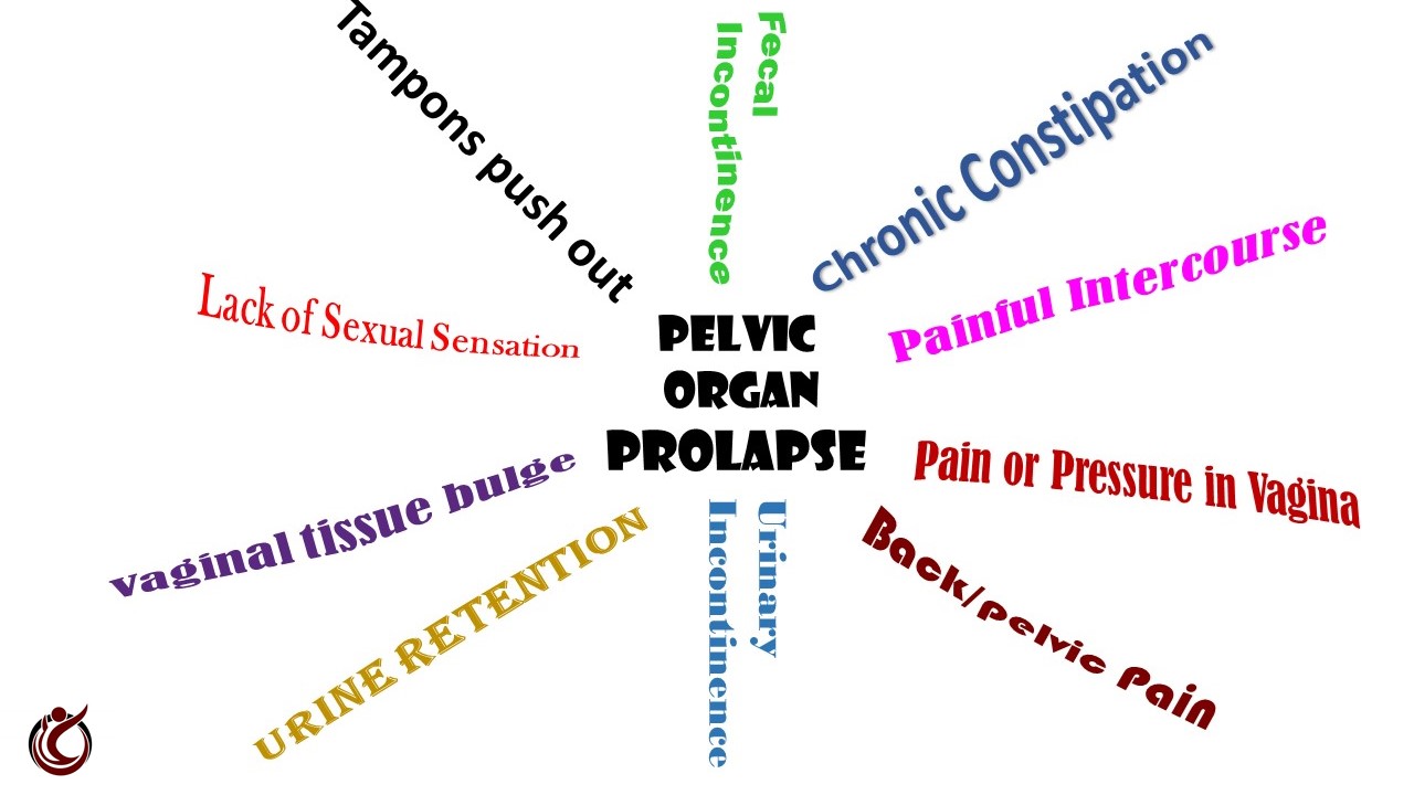 Pelvic Organ Prolapse Causes Symptoms And Treatments