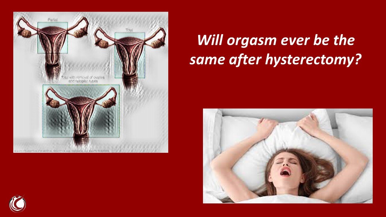 Will Orgasm Ever be the same After Hysterectomy for Uterine Prolapse? — APOPS