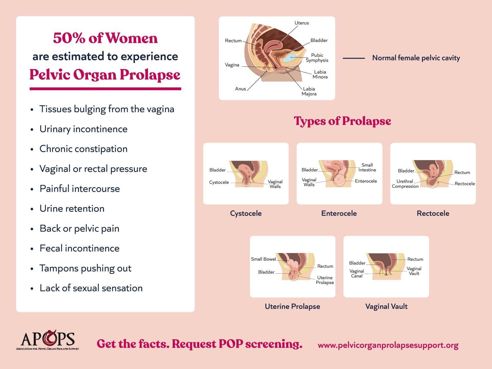 FINAL POP awareness poster -English 2048x1152.jpg