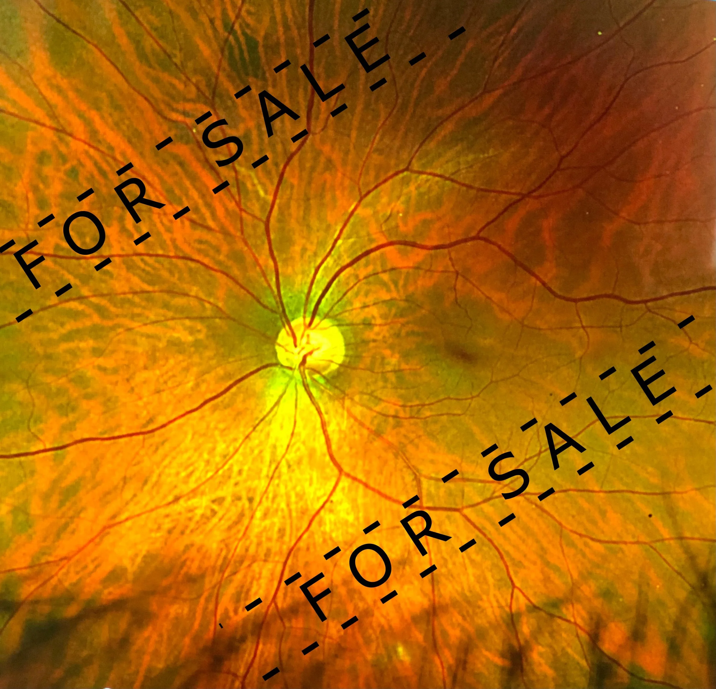 Mye Eye SAMPLE.jpg