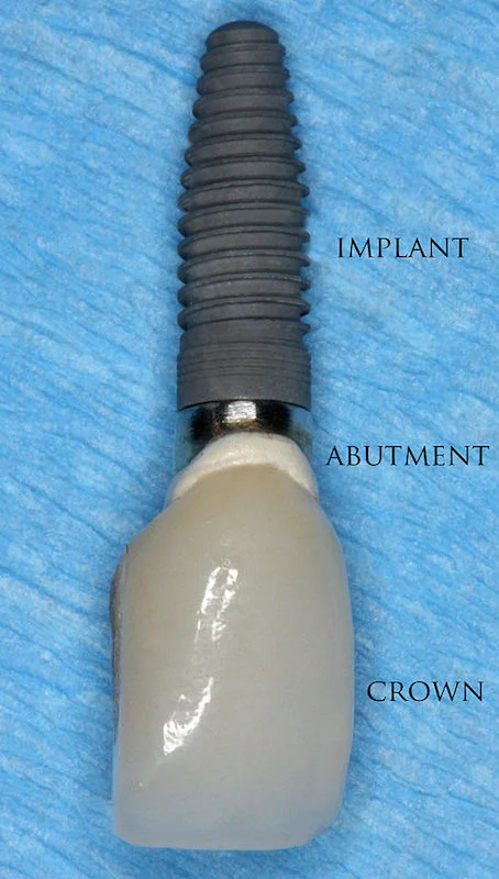 Photo credit: Coronation Dental Speciality Group
