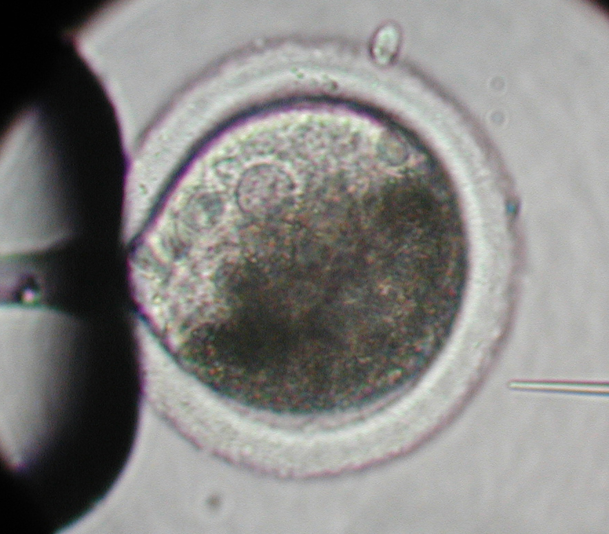 Pronuclear injection (bovine zygote)