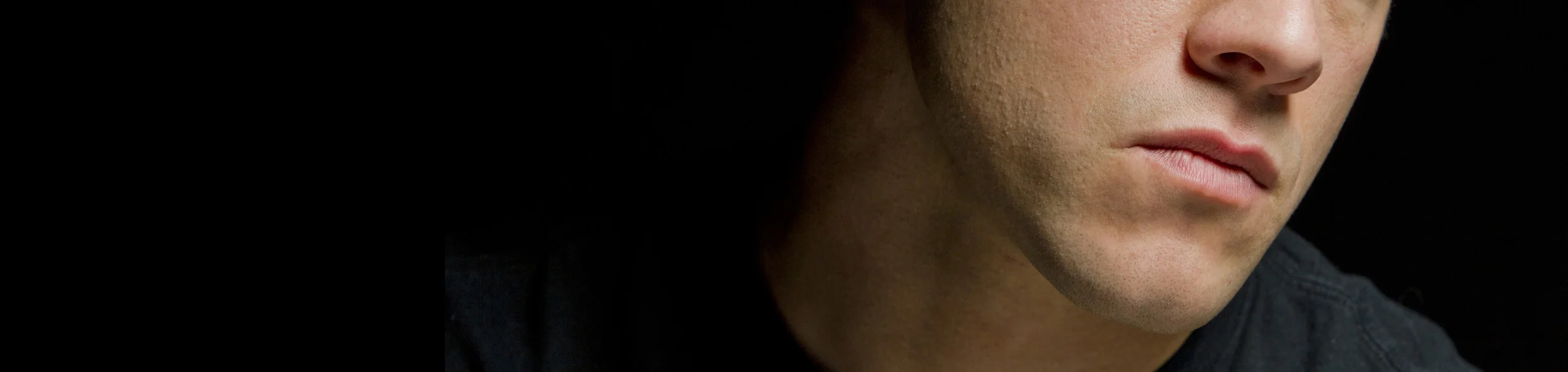 Click to see a selection of our Before and After Chin Photos.