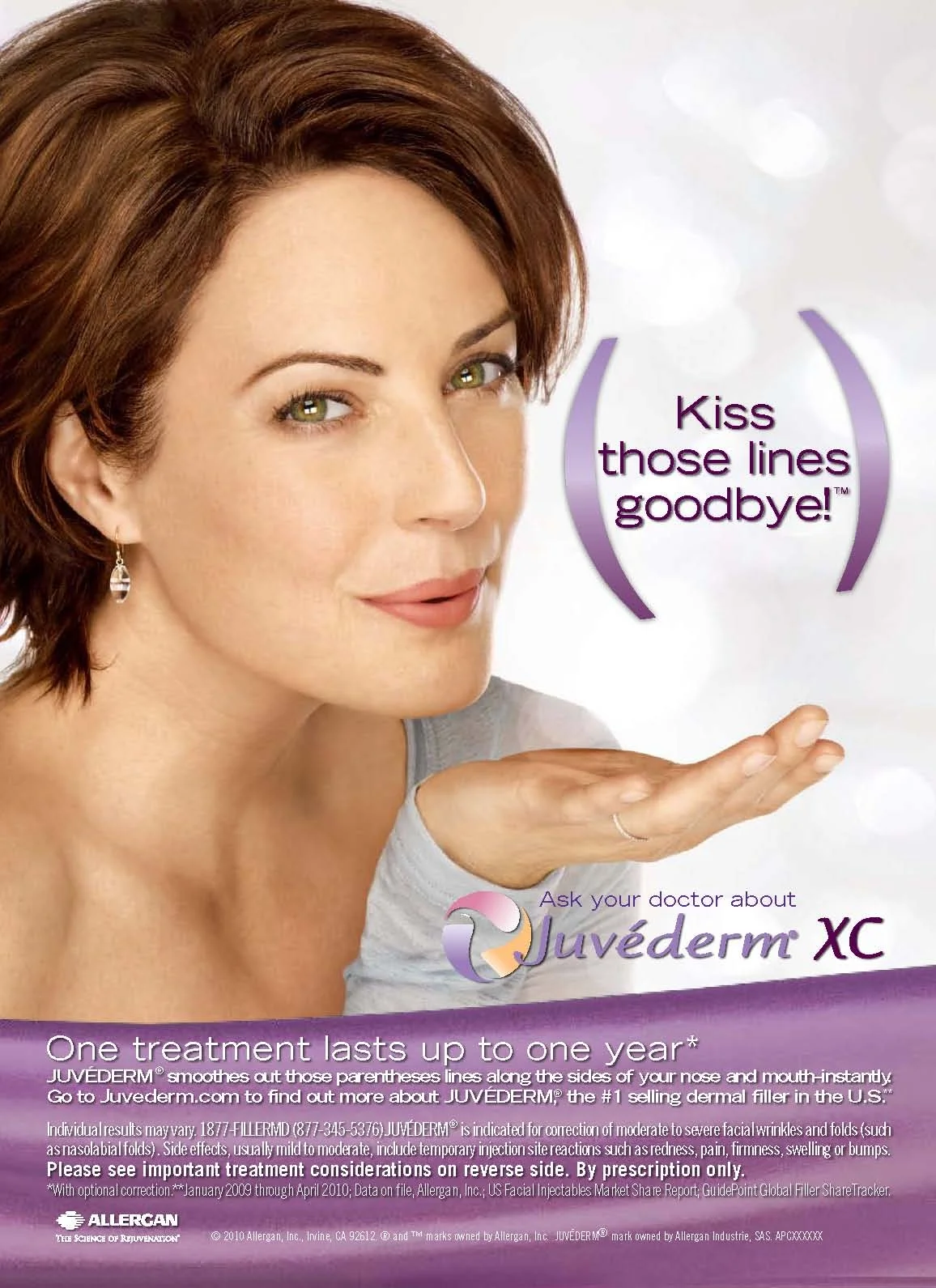 Juvederm Kiss them Goodbye
