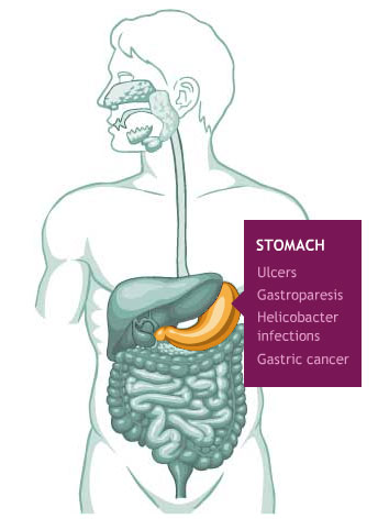 chart-stomach.jpg