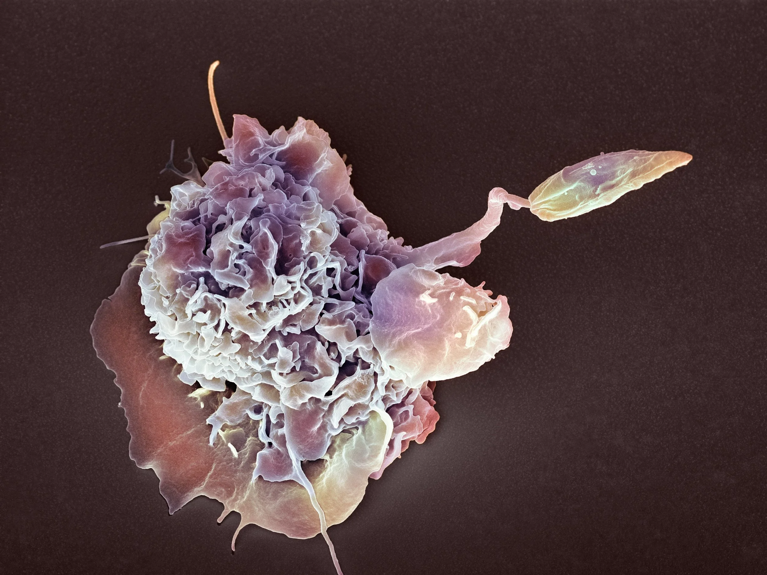 White blood cell eating a Leishmania parasite