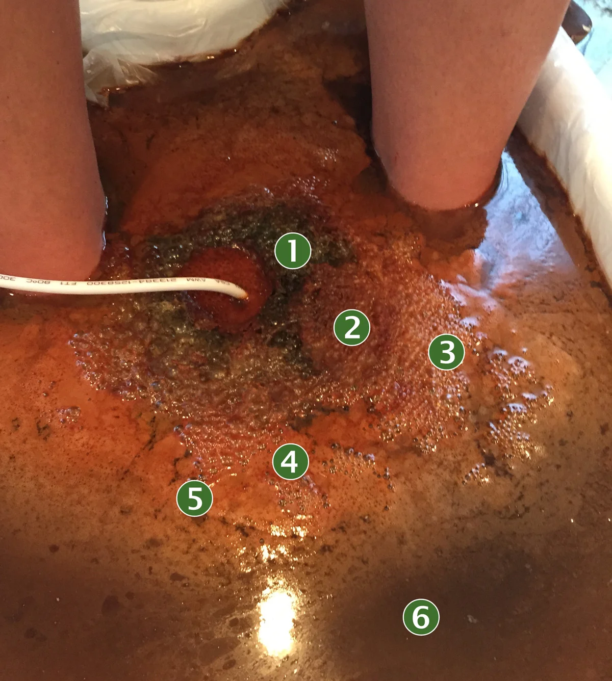 1 - Lyme Disease, 2 - Fat, 3 - Emotions, 4 - Taxed Liver, 5 - Skin Irritation, 6 - Liver Excretion