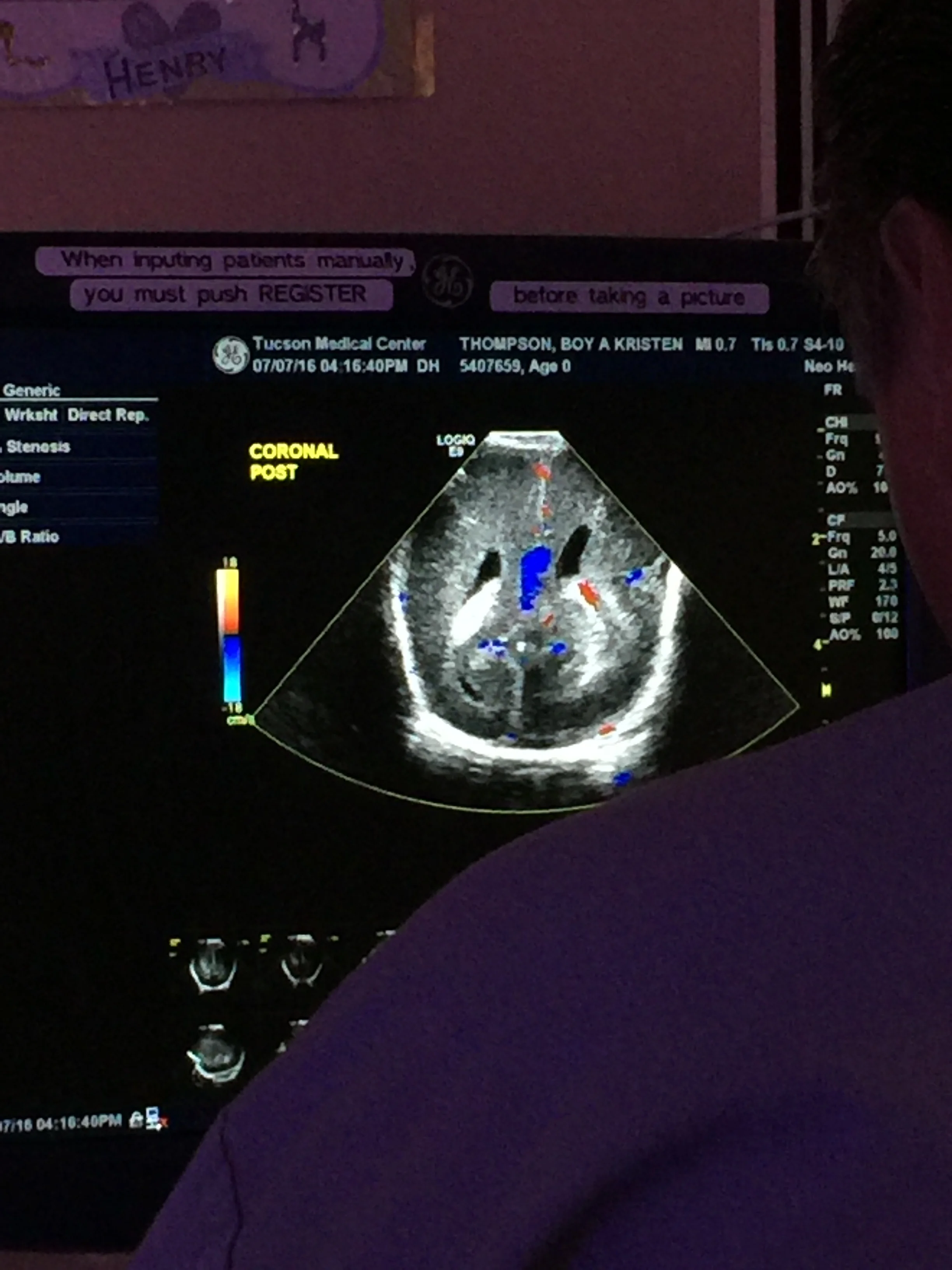 Dear Henry, a scare and the day you had a brain scan. 