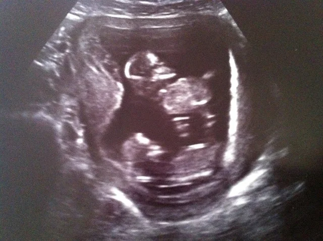 I'm Not Actually Having A Baby.