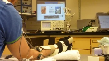 4-site intramuscular direct myoelectric control