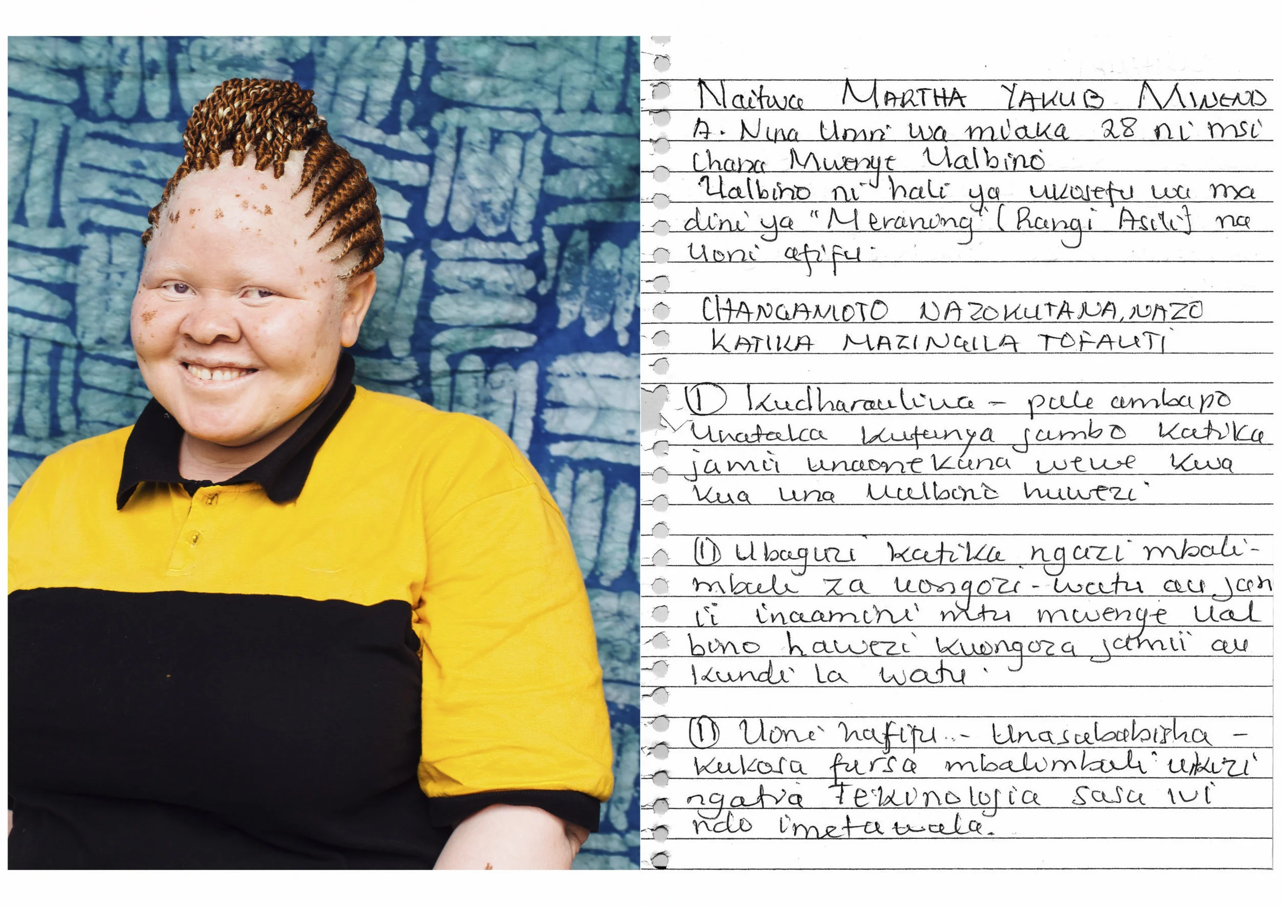 My name is MARTHA YAKUB MINENDA. I am 28 years old. I am a girl with albinism. Albinism is a disorder of lacking melanin (pigmentation) and low vision. CHALLENGES THAT I FACE IN DIFFERENT SETTINGS i. Being despised – when you want to do something in the society and you are regarded as incapable because of your albinism. ii. Being discriminated in different levels of leadership. Most people in the society believe people with albinism cannot lead the society or a group of people. iii. Low vision – it causes us to miss different opportunities, considering that technology rules at the moment. ADVICE My advice is for civil society organizations and other organizations to partner up and educate the society especially in schools, workplaces, and hospitals because stigma in these areas is extreme.