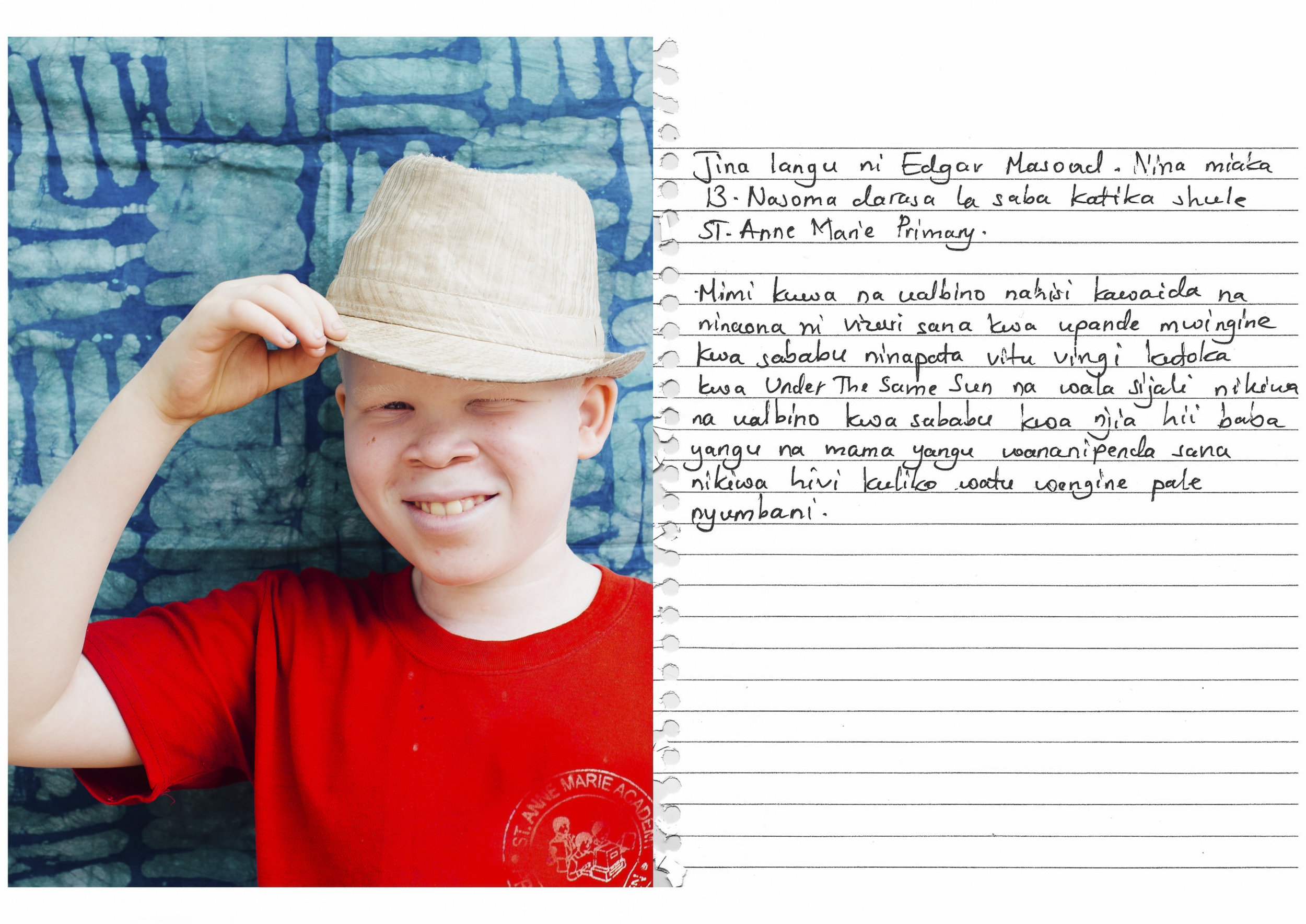 My name is Edgar Masoud. I am 13 years old. I am in standard 7 at St. Anne Marie Primary School. For me to have albinism is just a normal feeling, and on the other part I see it as a good thing because I get much support from Under the Same Sun. Likewise, I don't feel bad to have albinism because through this condition my parents love me more than anybody else at home. 