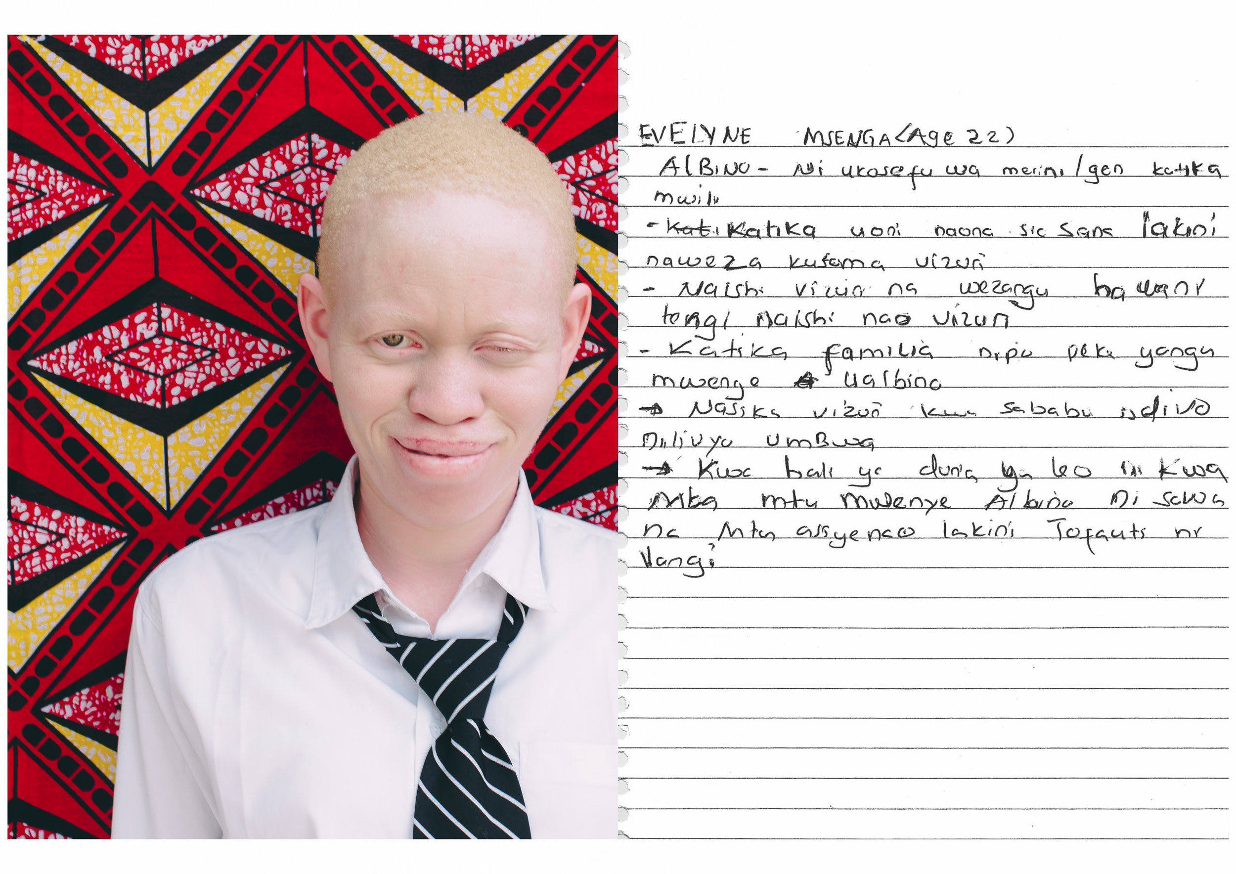Evelyne Msenga (22 years old) I am in Form 6 at St. Anne Marie - Albinism, a condition whereby one lacks melanin in the body. - I can see, though not very clearly, but I can ready very well. - I live very well with my schoolmates, they do not tease me. - I am in the only person in my family who has albinism. - I feel good to be this way, because this is the way God created me. - In today's world, people with albinism are considered unequal with other people who do not have albinism, the situation is still challenging. 