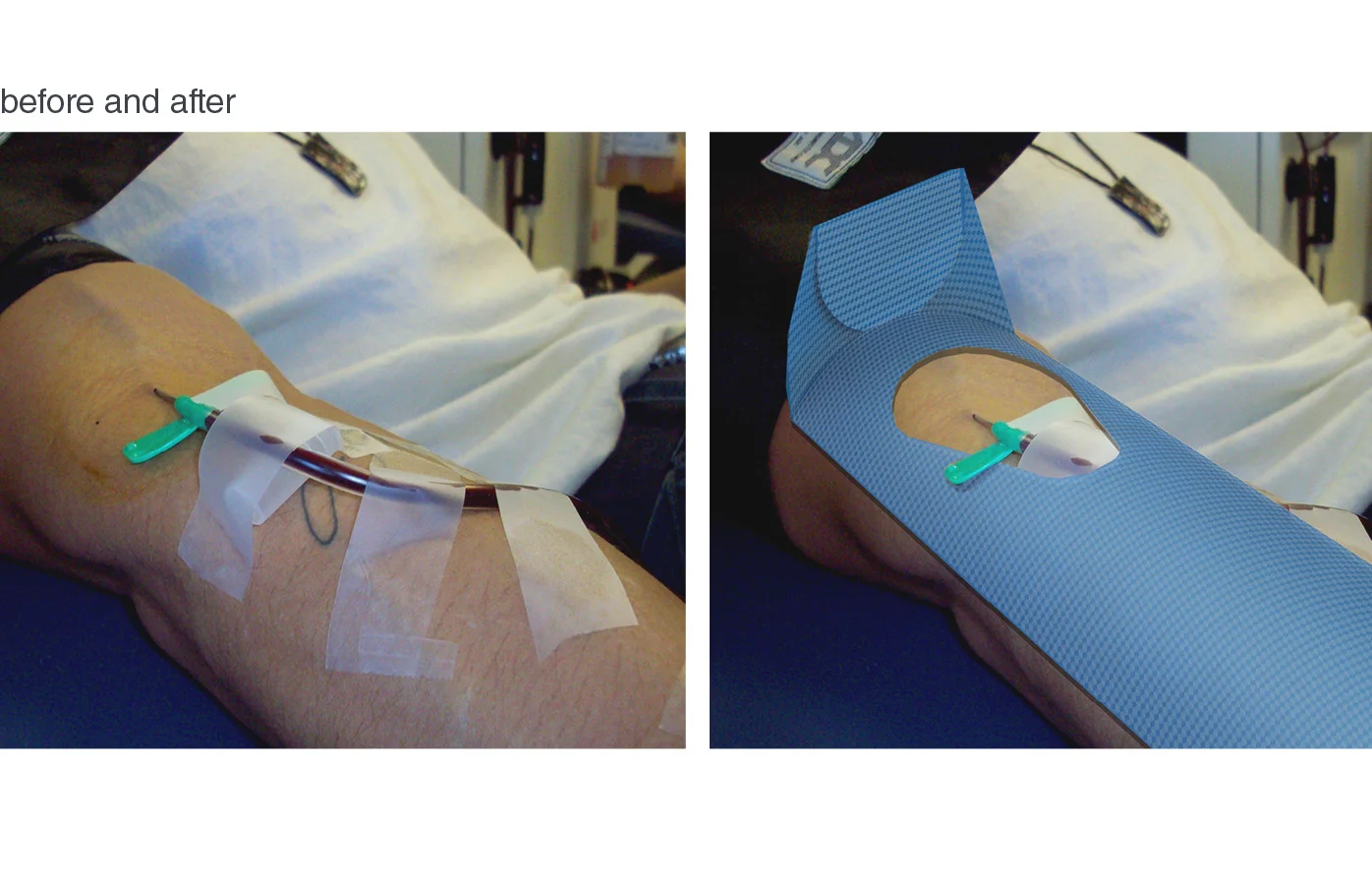 research_slideshowbandage2.jpg