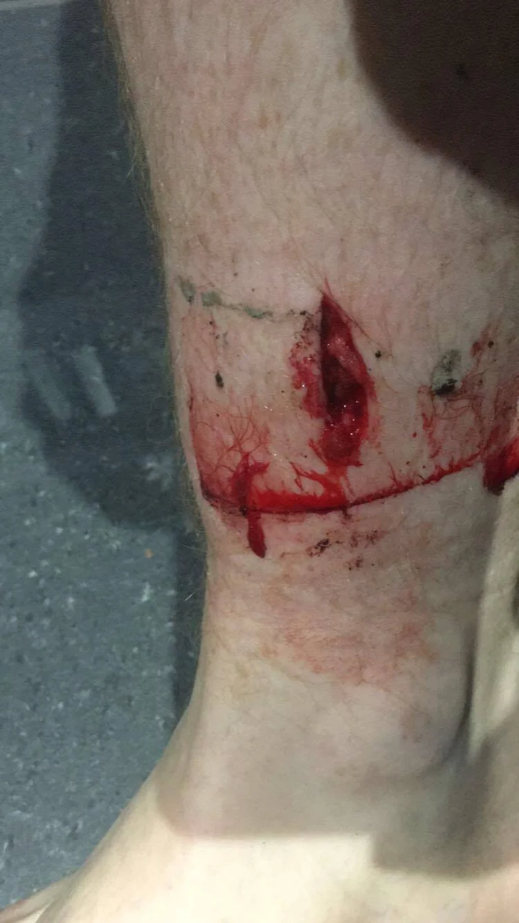 Cheval Rouge takes a chunk out his leg on his way over the bars.