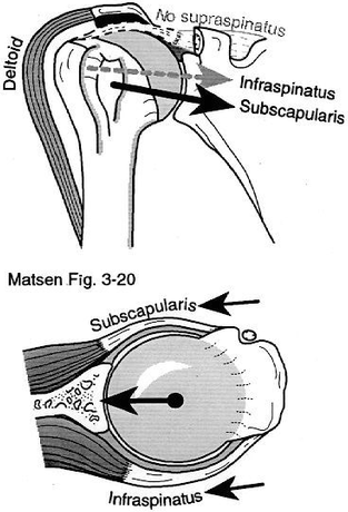 rotator cuff.png