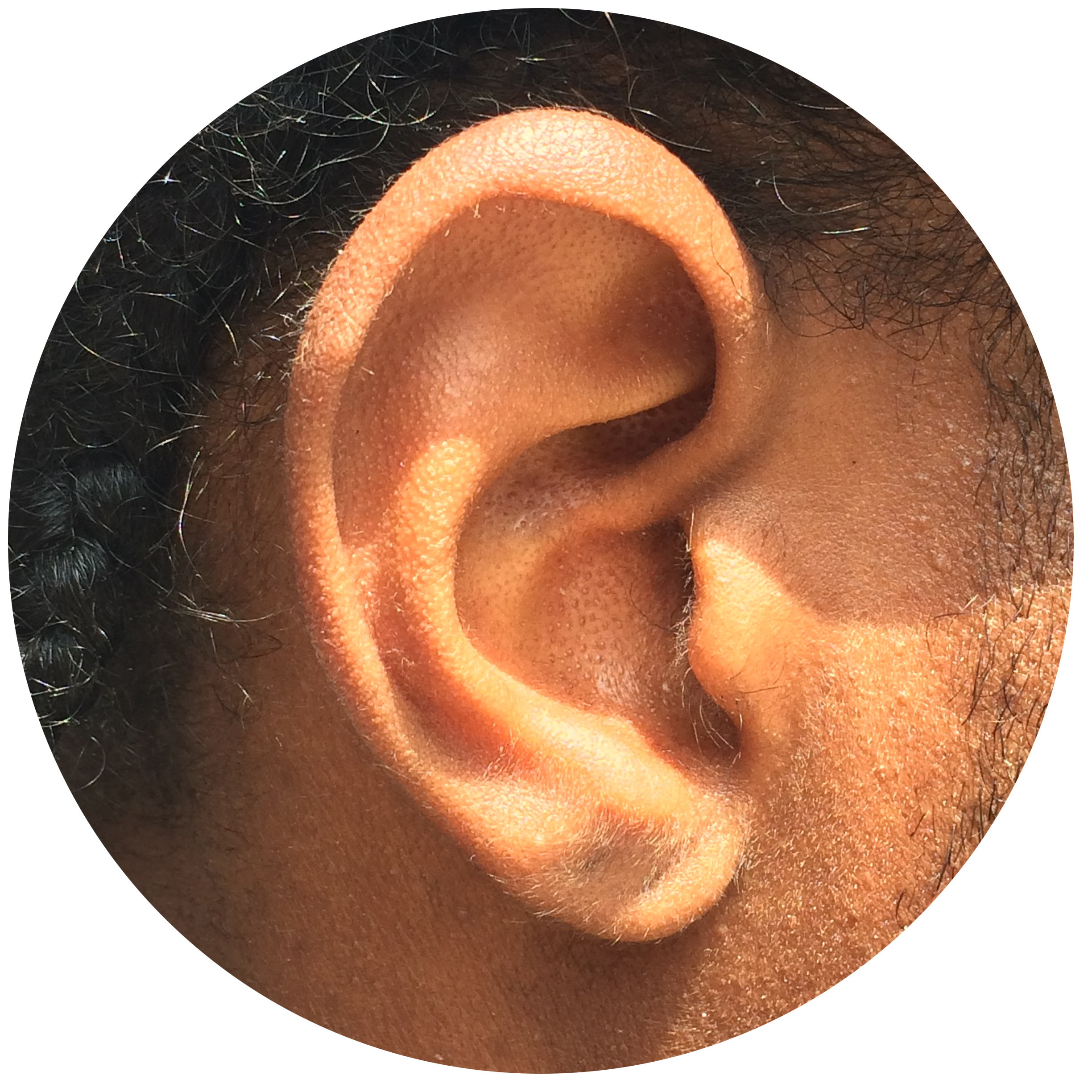 Lawrence Ear.jpg