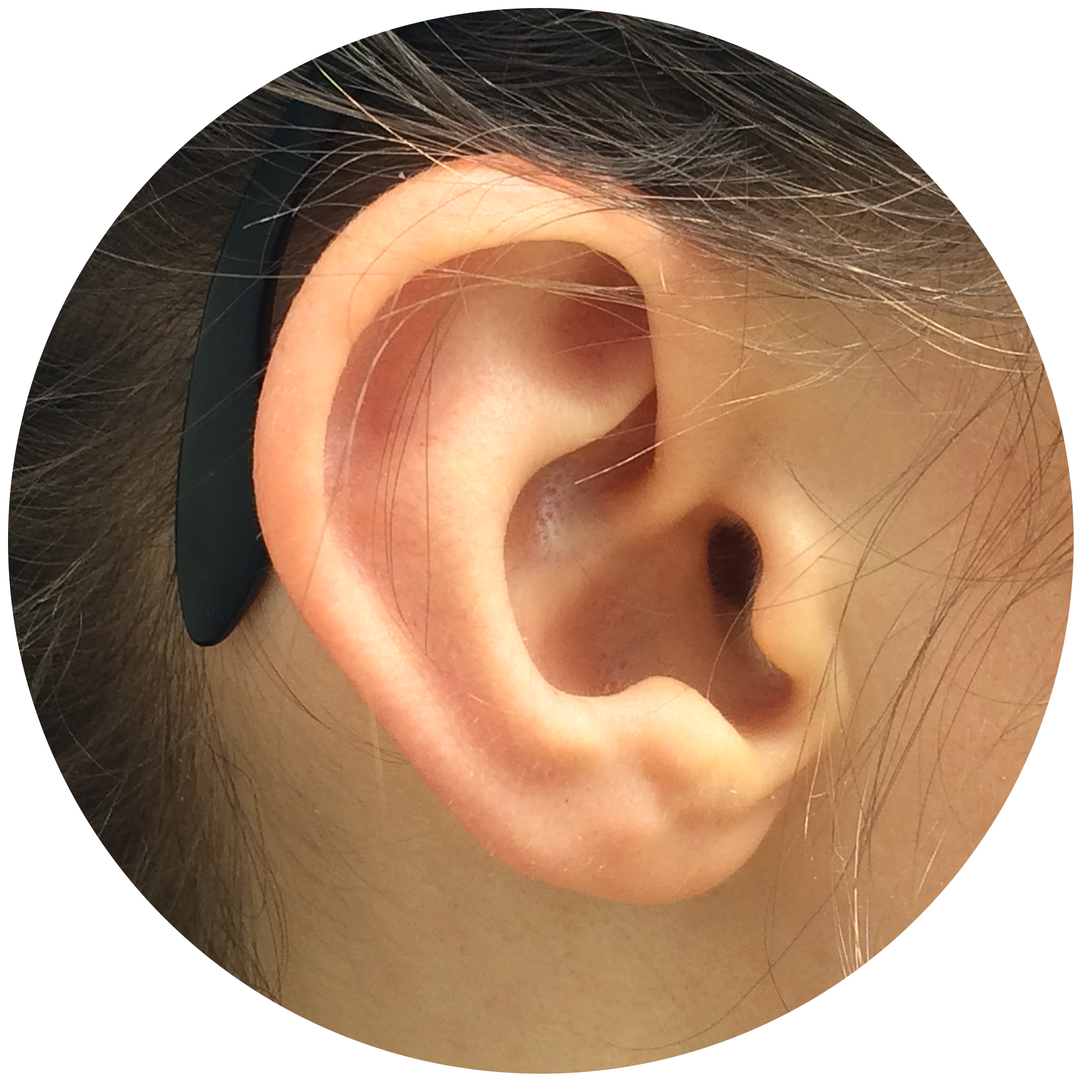 Leigh Ear.jpg