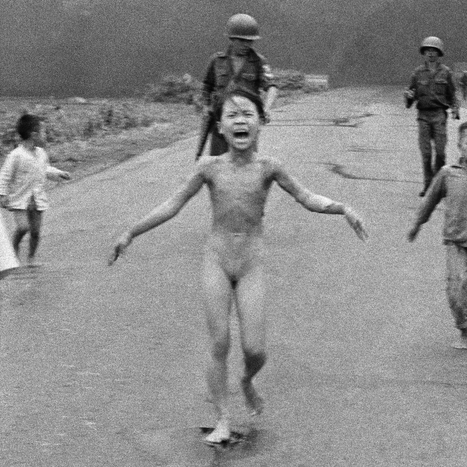 Burned by napalm dropped by our "allies" in Vietnam. Where is the memorial in Washington for millions of Vietnamese dead?