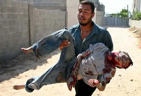 This is called "collateral damage". That and similar euphemisms allow us to keep our distance from humanitarian catastrophes.