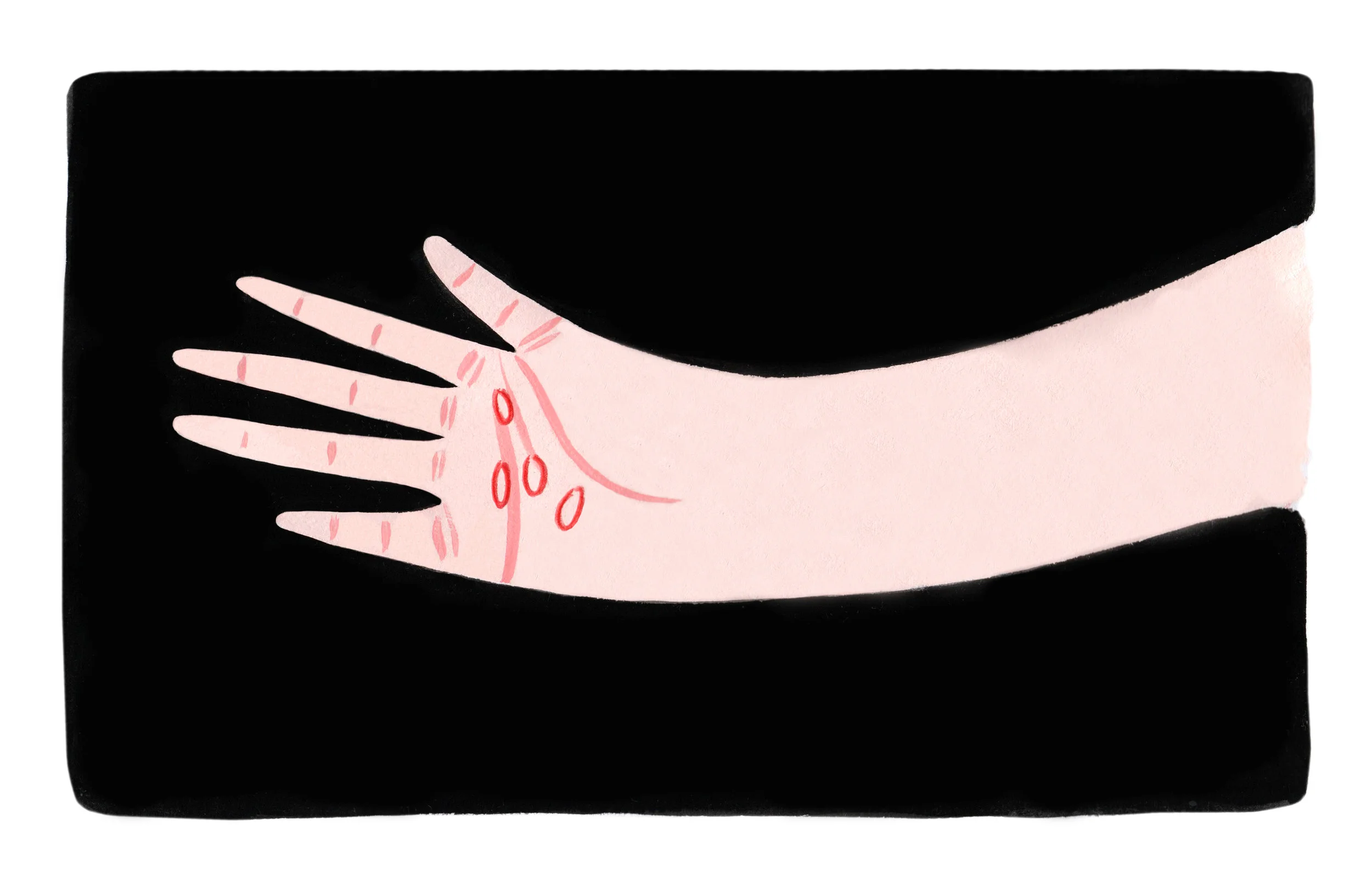what it feels like to go on accutane (for teen vogue)